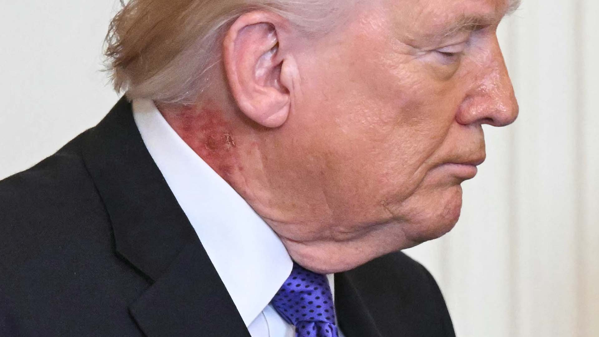 trumps-neck-looks-like-it-needs-a-green-herb